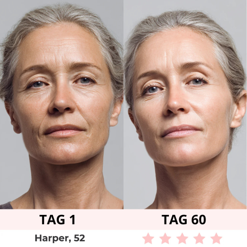 AURELIA  RED LIGHT UNDER-EYE GLASSES