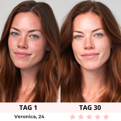 AURELIA  RED LIGHT UNDER-EYE GLASSES